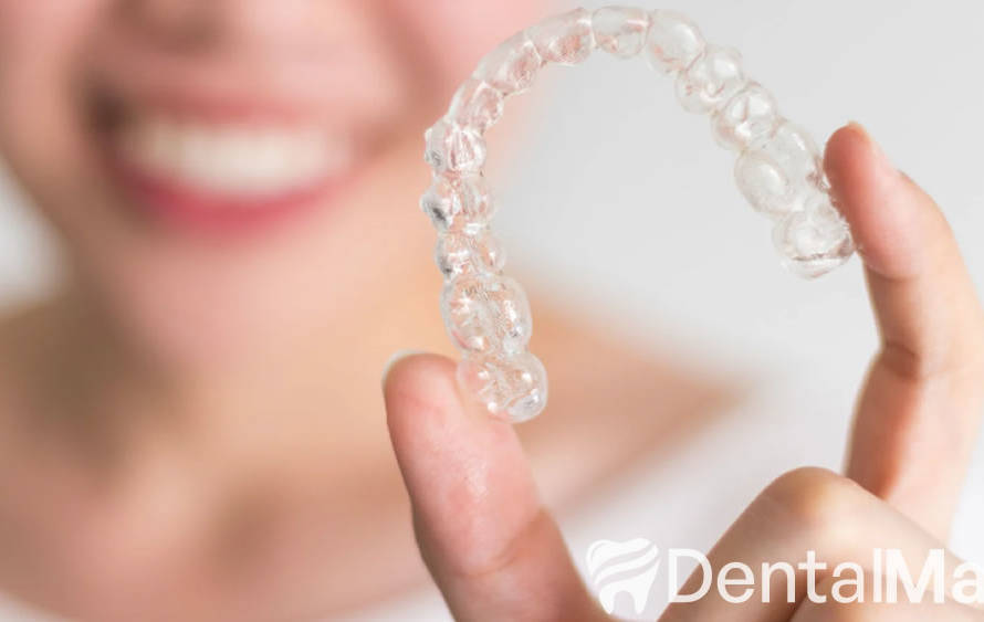 Precio invisalign Madrid